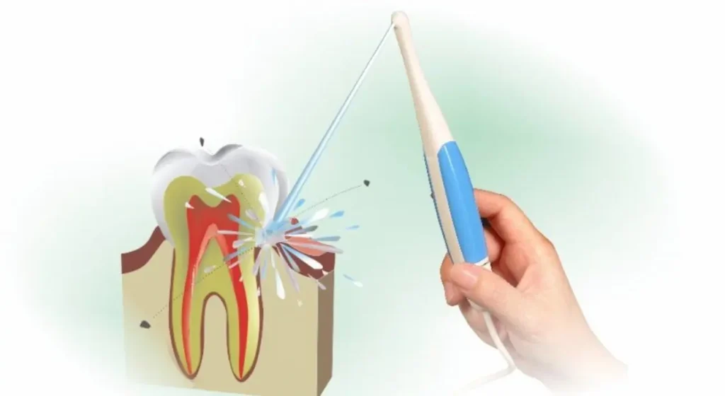 Find out if the dental irrigator is good for your mouth or not