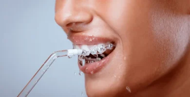 ¿Por qué deberías utilizar un irrigador dental para limpiar tu ortodoncia?